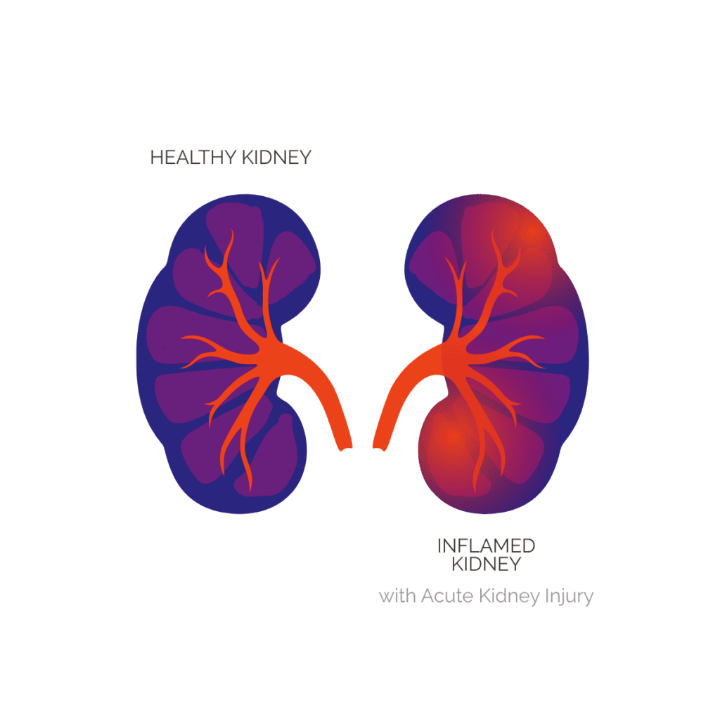 kidney-calcimedica