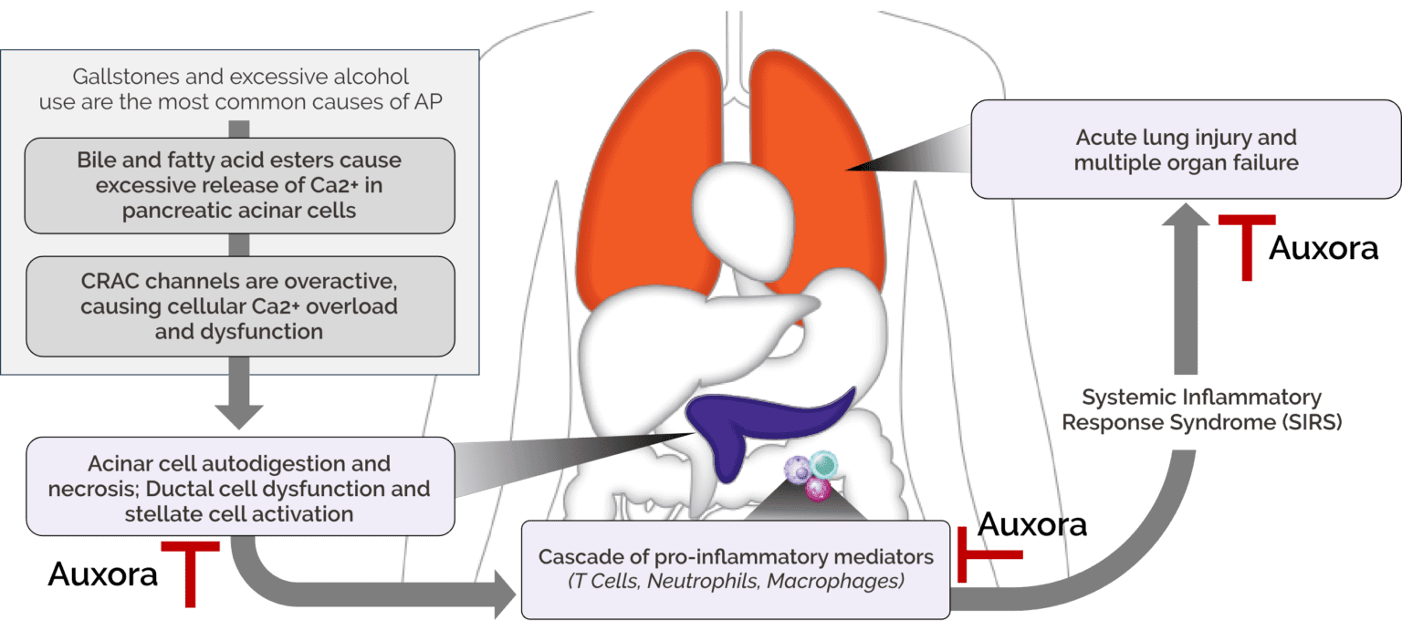 Over-Active-Calcium-Illus